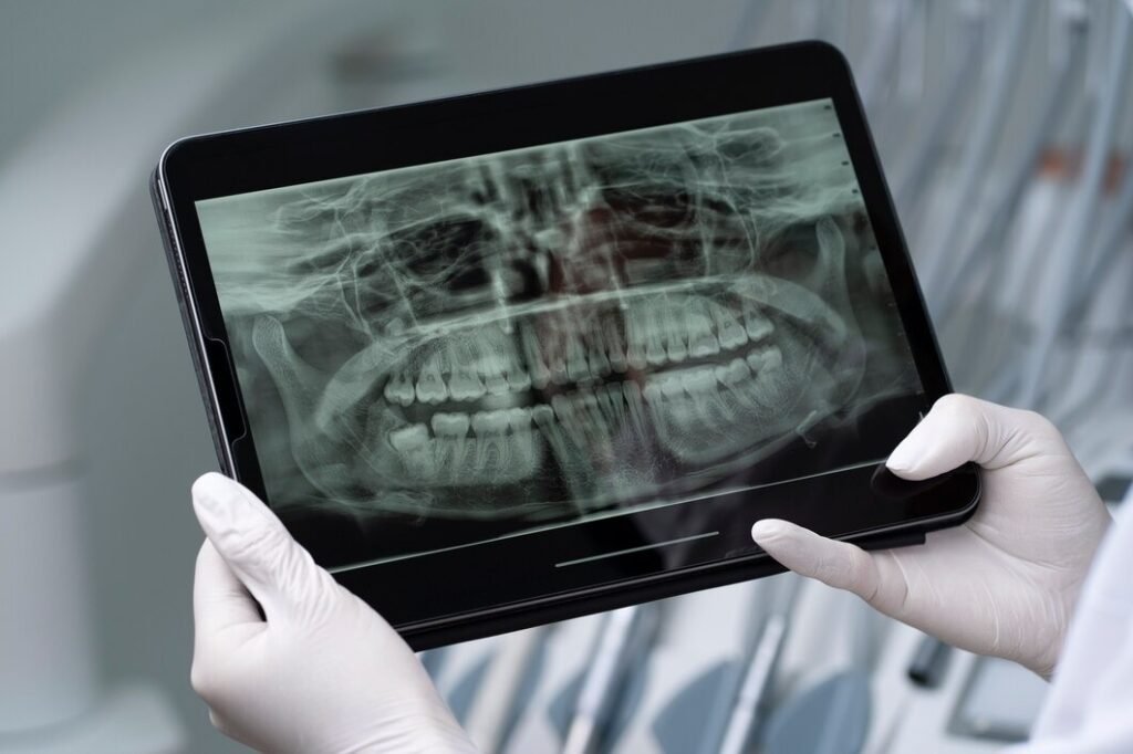 Top Digital X-Ray Service in Rajendra Nagar