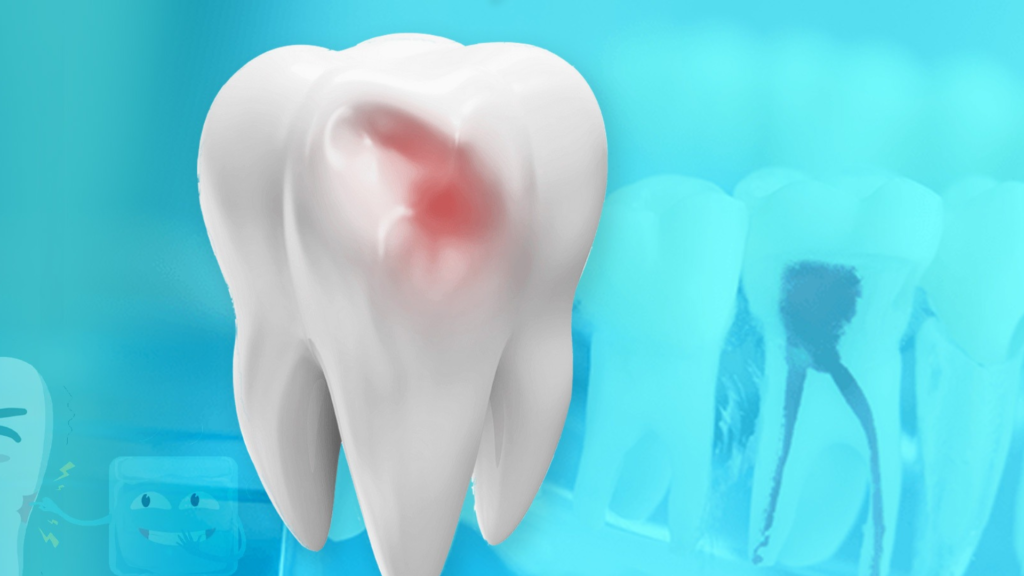 Top Teeth Sensitivity in Rajendra Nagar