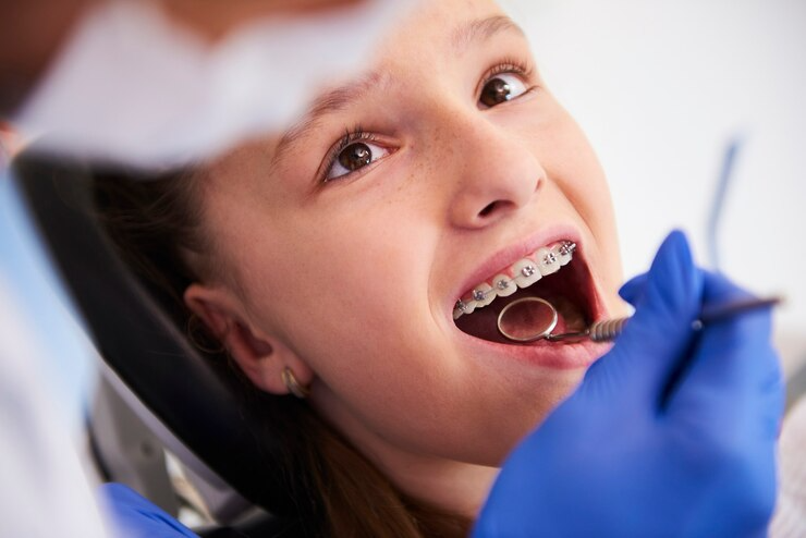 Best Braces Treatment in Rajendra Nagar