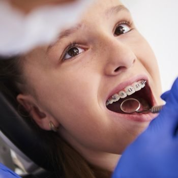 girl-with-braces-routine-dental-examination (1)